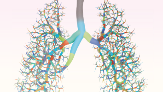 Image of lungs with branches representing the genetic variations only recently found in different patients with small cell lung cancer