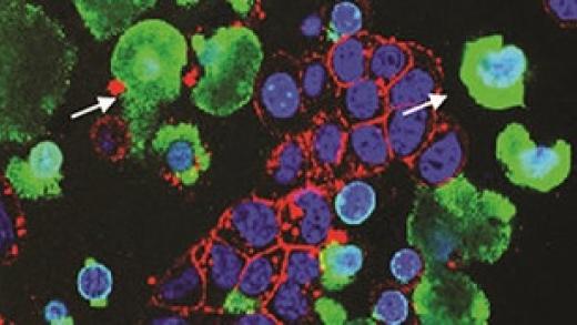 4T1 breast cancer cells treated with apoptosis-inducing drug, expelled chromatin marked with arrows