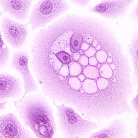 HPV oncogene