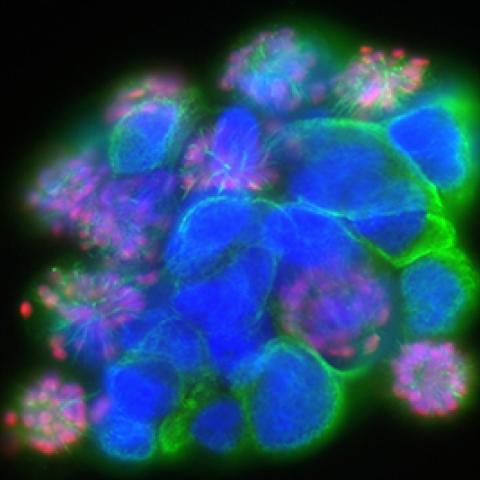 Patient-derived glioma stem cells