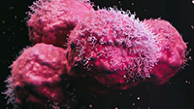 Tumor cells