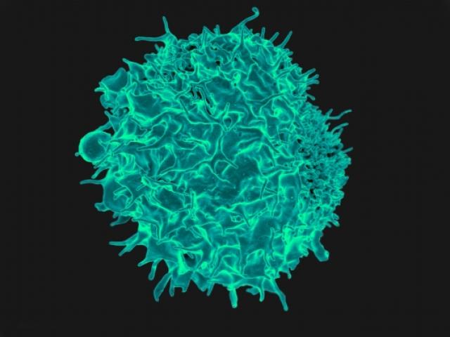 A colorized scanning electron micrograph of a T lymphocyte used in immunotherapy.