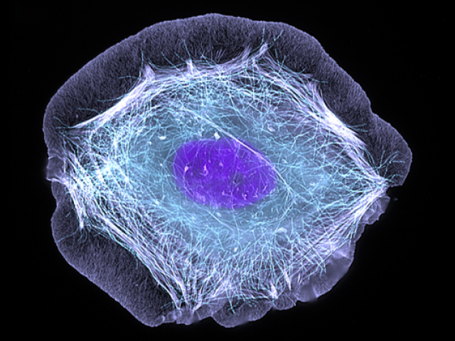 human skin cell treated with a growth factor that enabled the cell to move