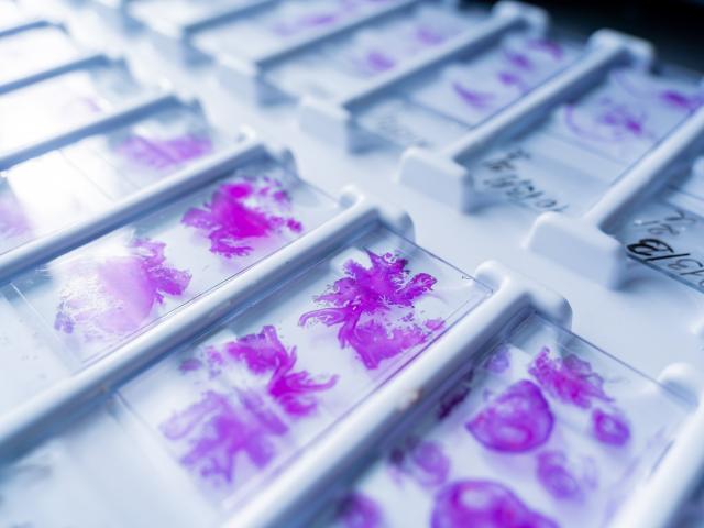 Rows of glass microscope slides with purple-dyed cells