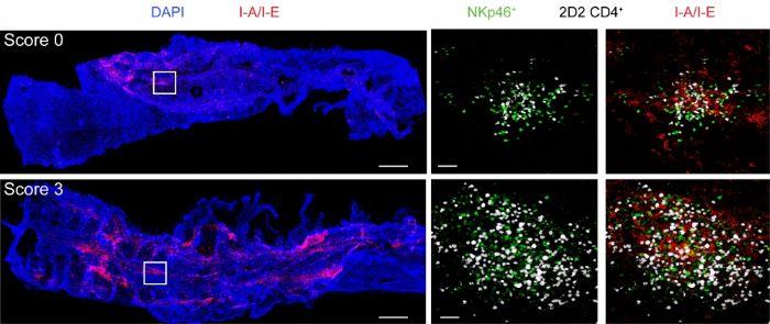 Localization of T-bet-dependent NKp46+ ILCs during EAE