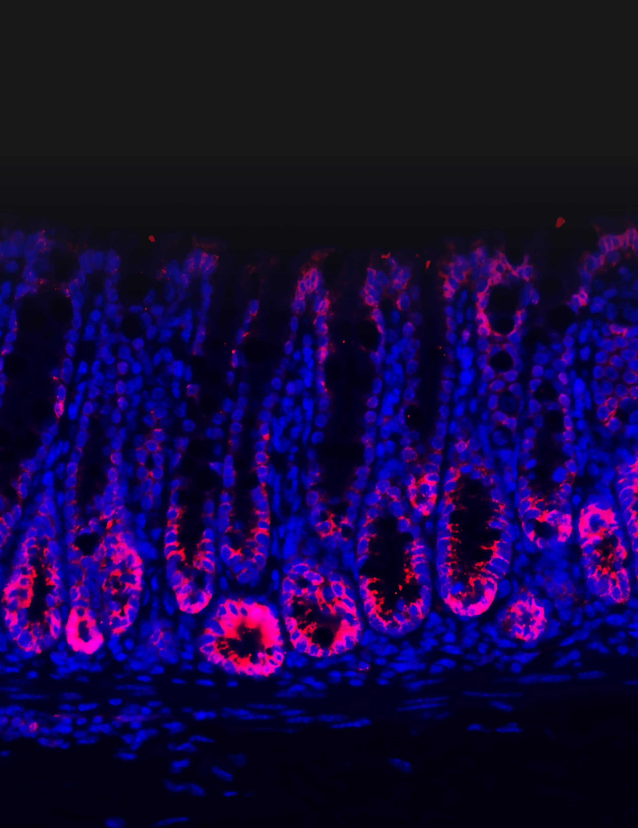 This image depicts intestinal tissues stained for PEDF protein (pink) from healthy mice. The liver produces PEDF, which binds to stem cells in the intestine and stops them from over-proliferating. When the intestines are damaged, they release signals that block PEDF production, liberating stem cell expansion to heal the gut.