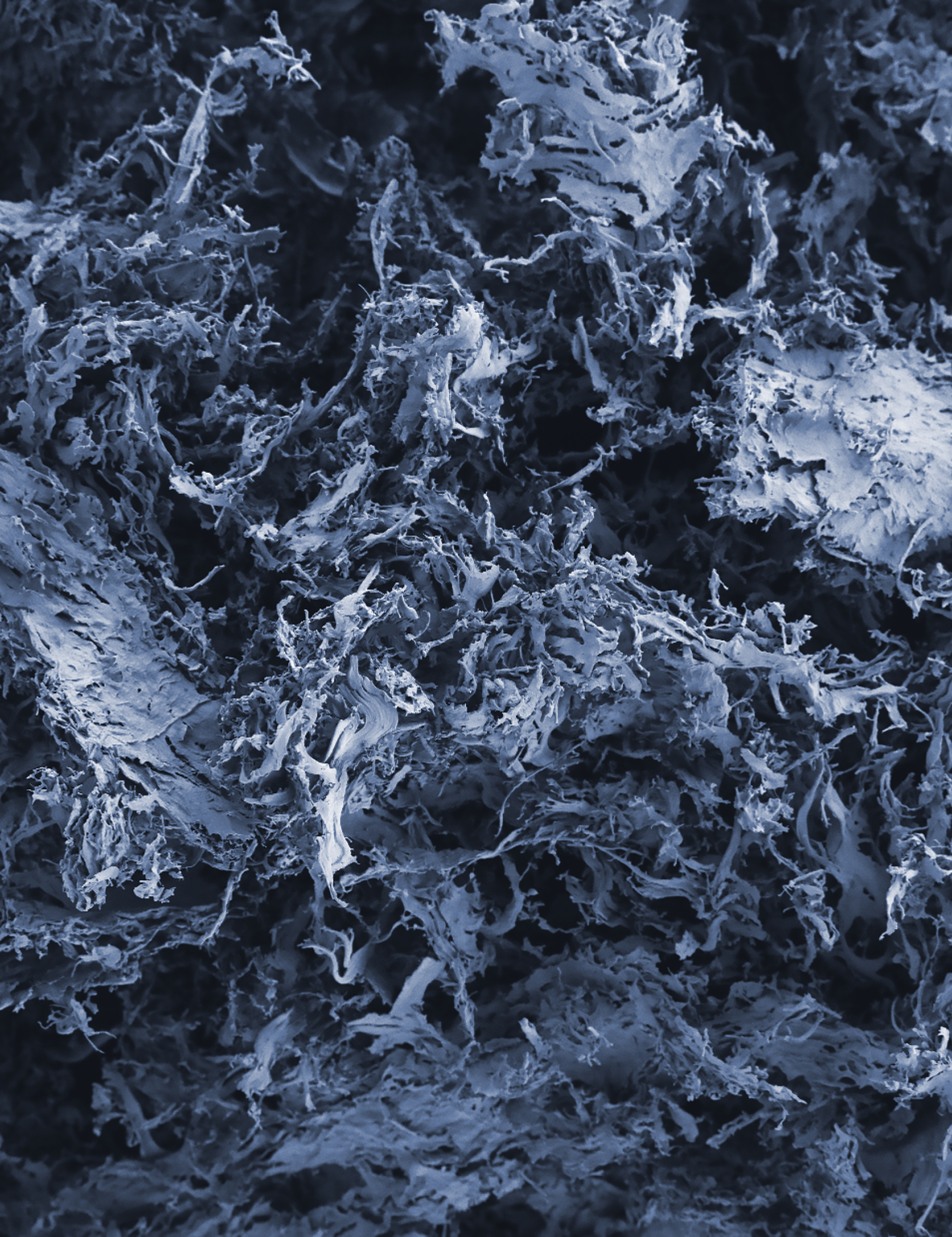 scanning electron microscope image of a biocompatible, porous and degradable scaffold