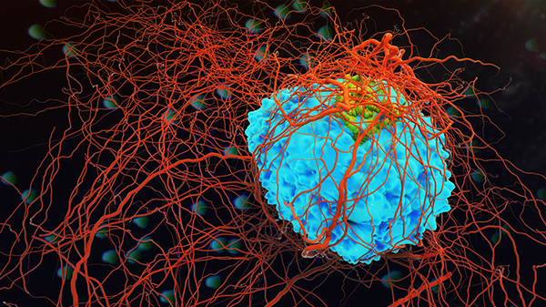 A 3D illustration of a cancer cell