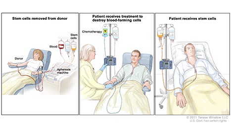 Cartoon of patients receiving stem cells