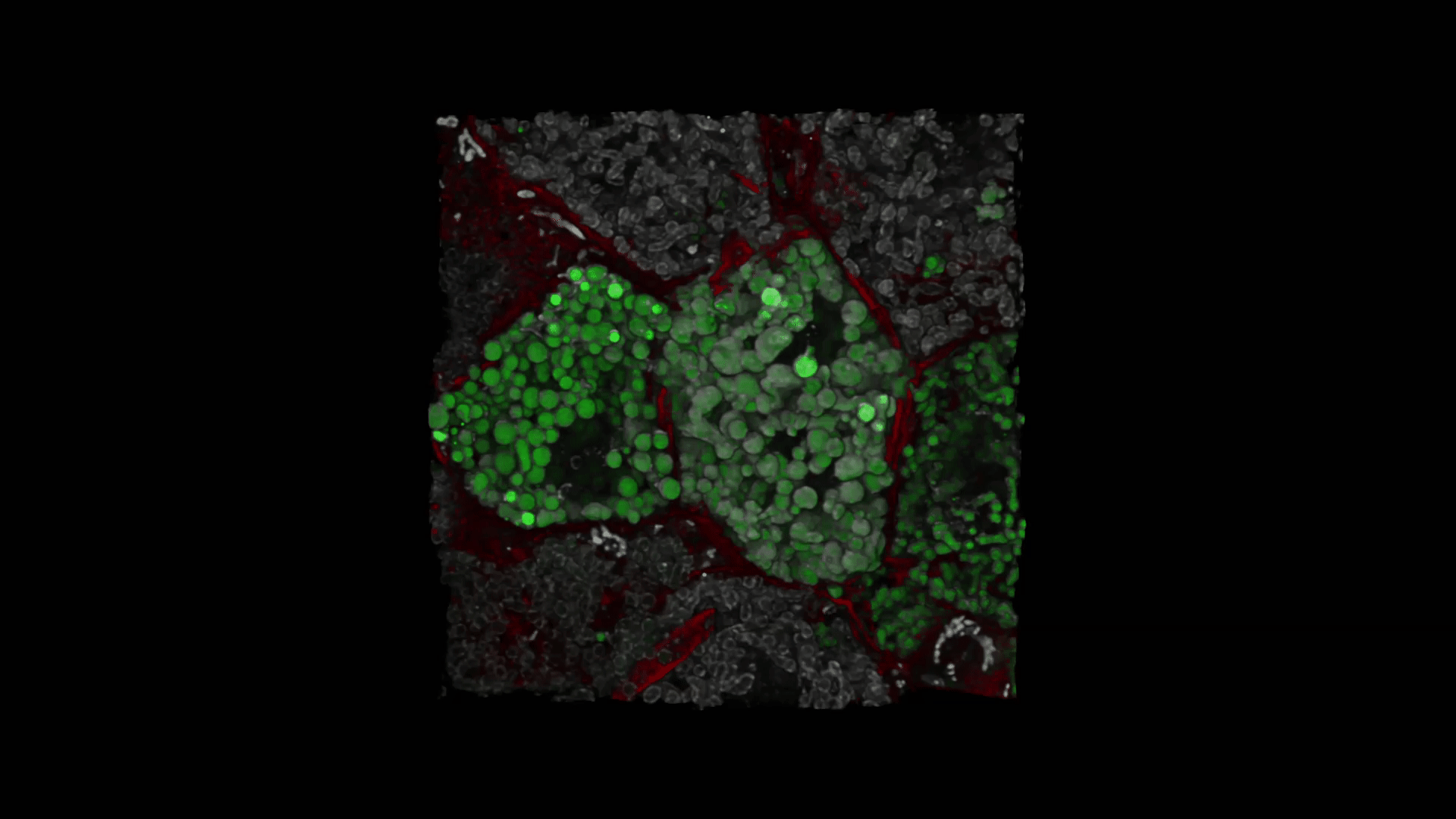 3D reconstruction of hepatic mitochondria in the intact tissue. mitochondria matrix (green), mitochondria outer membrane (white), actin (red).