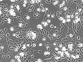 Picture 9 - Microscopic image of tumor cells growing