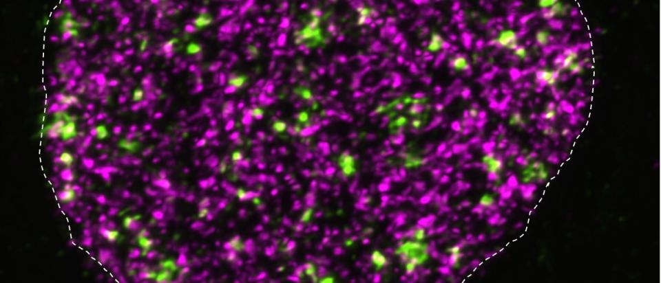 DNA breakage and synthesis in the cell nucleus