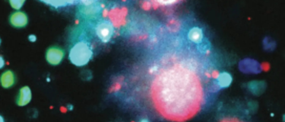 Immunofluorescence image of the cell adhesion protein basigin (turquoise) in TuNEPs released from dying 4T1 mouse breast cancer cells. 