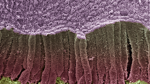 A colored scanning electron micrograph of a bile duct. 