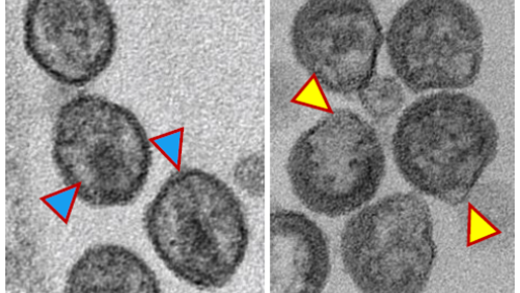 Electron microscopy of HIV. Left: mature particles; Right: immature particles