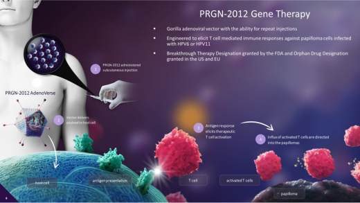 PRGN-2012 gene therapy for adult patients with recurrent respiratory papillomatosis
