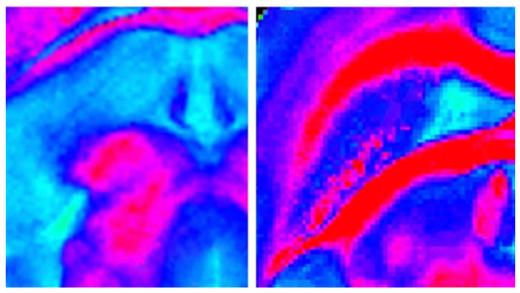 Two microscopy images showing close-ups of the mouse brain before and after radiation exposure.