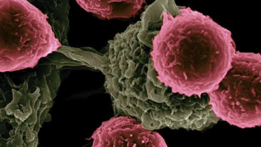 dendritic cells, pseudo-colored in green, interacting with T cells, pseudo-colored in pink.