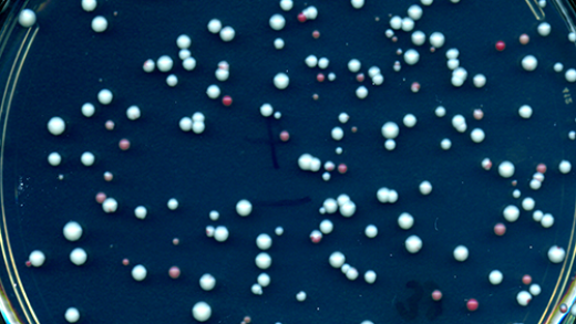 uniparental disomy has occurred in the red and pink yeast colonies but not in the white colonies