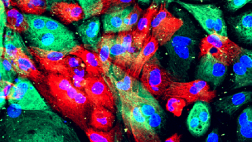 Wild-type human prostate cells from an organoid (a man-made construct that resembles an organ).
