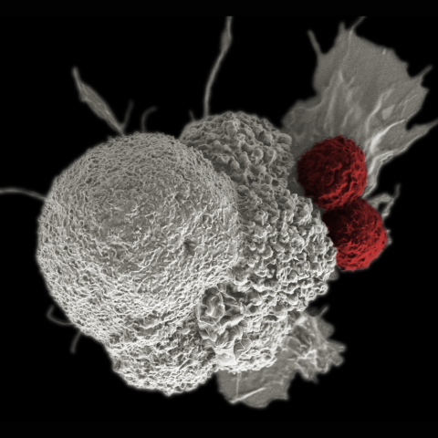 Cytotoxic T cells (red) are shown attacking a squamous cancer cell (white).