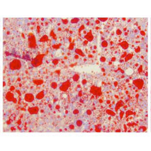 Histochemical staining of liver tissue