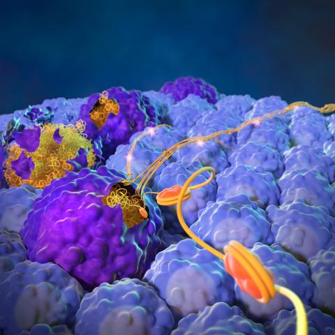 Cancer cells that die via apoptosis (larger dark purple structures) expel their nuclear contents (orange and yellow stringy structures) to spur metastasis and growth of living cancer cells (smaller light blue structures). Image credit: Yang Lab