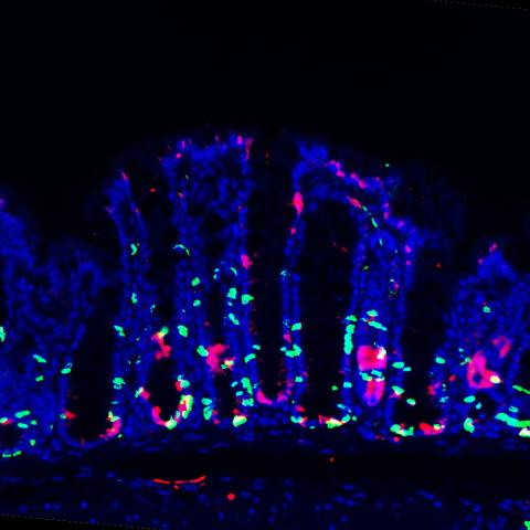 An image of mouse colon tissue (blue), proliferating stem cells (green) and PEDF (red). Image credit: Girak Kim, et al.