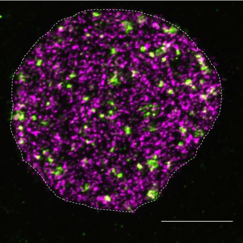 DNA breakage and synthesis in the cell nucleus