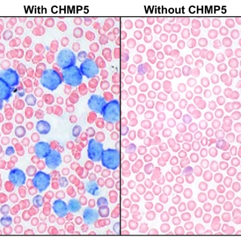 Blood from wildtype mice (left) showing blast-like T-ALL cells with characteristic blue nuclear staining; blood from mice in which CHMP5 is deficient in thymocytes (right) showing no evidence of T-ALL cells in the blood.