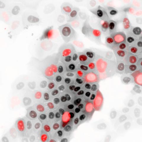 Cells showing the biosensor used in this study to test the activity of APC/C