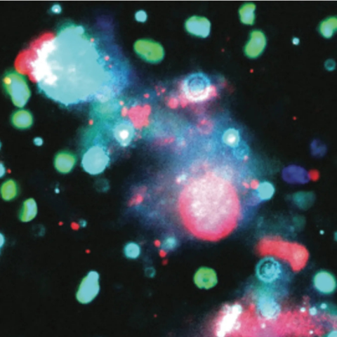Immunofluorescence image of the cell adhesion protein basigin (turquoise) in TuNEPs released from dying 4T1 mouse breast cancer cells. 