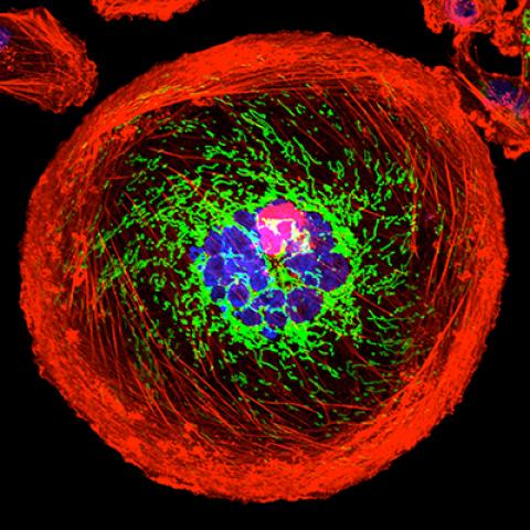 Polyploid giant cancer cell 