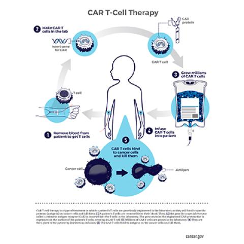 Chart on how CAR T-cell therapy works