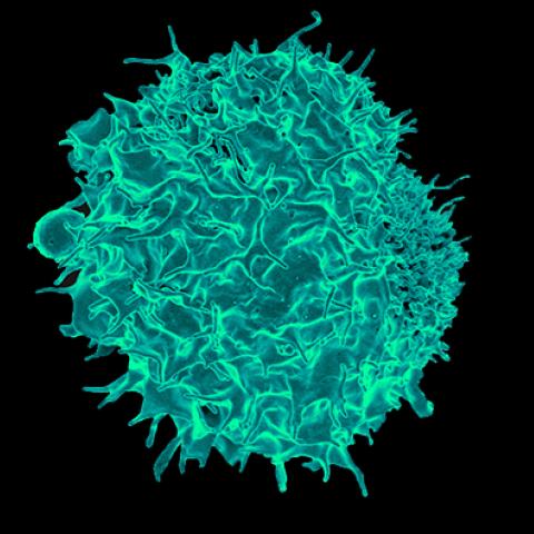 A scanning electron micrograph of a T lymphocyte