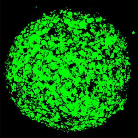 Mesothelioma Spheroid
