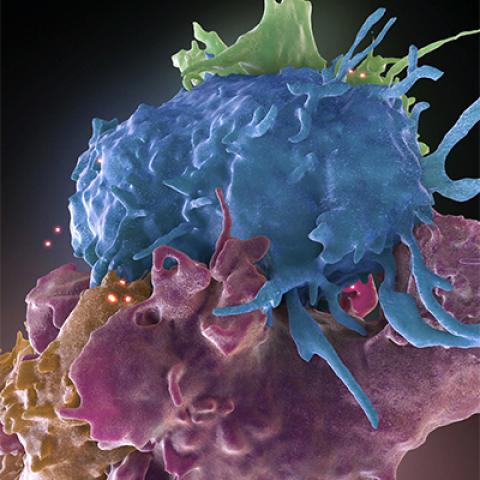 HIV infecting healthy cell