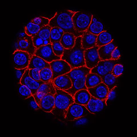 Pancreatic Cancer Cells