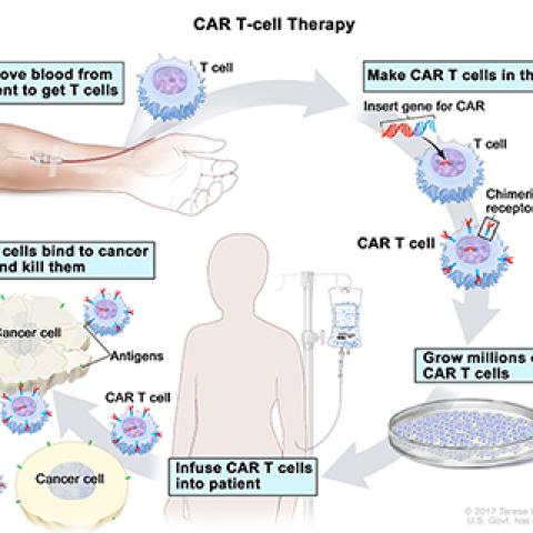 CAR T-cell therapy