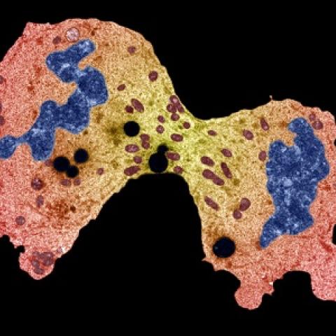 rhabdomyosarcoma cells