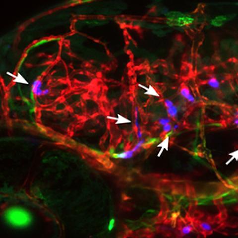 Human breast tumor cells arrested in the blood vessels of zebrafish larvae