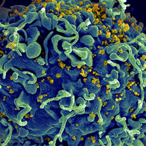 HIV cell