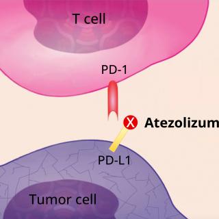Normally, tumor cells evade T cells by expressing a checkpoint protein known as PD-L1 (left). Atezolizumab (Tecentriq) binds to PD-L1 and blocks it from binding to another checkpoint protein, PD-1 (right). This helps T cells regain their ability to kill tumor cells.