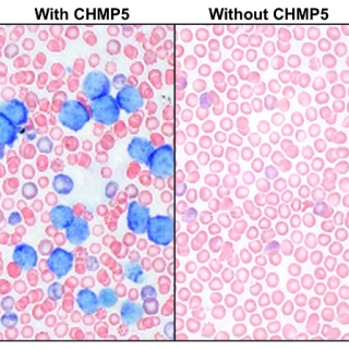 Blood from wildtype mice (left) showing blast-like T-ALL cells with characteristic blue nuclear staining; blood from mice in which CHMP5 is deficient in thymocytes (right) showing no evidence of T-ALL cells in the blood.