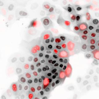 Cells showing the biosensor used in this study to test the activity of APC/C