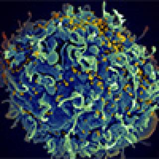 Human T cell (blue) is under attack by HIV (yellow)