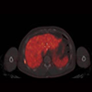 Prostate imaging