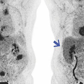 Patient scan