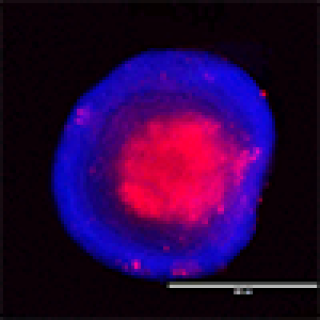 HCT116 (KRAS-mutant) colorectal cancer cell spheroid.