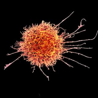 Human Natural Killer Cell